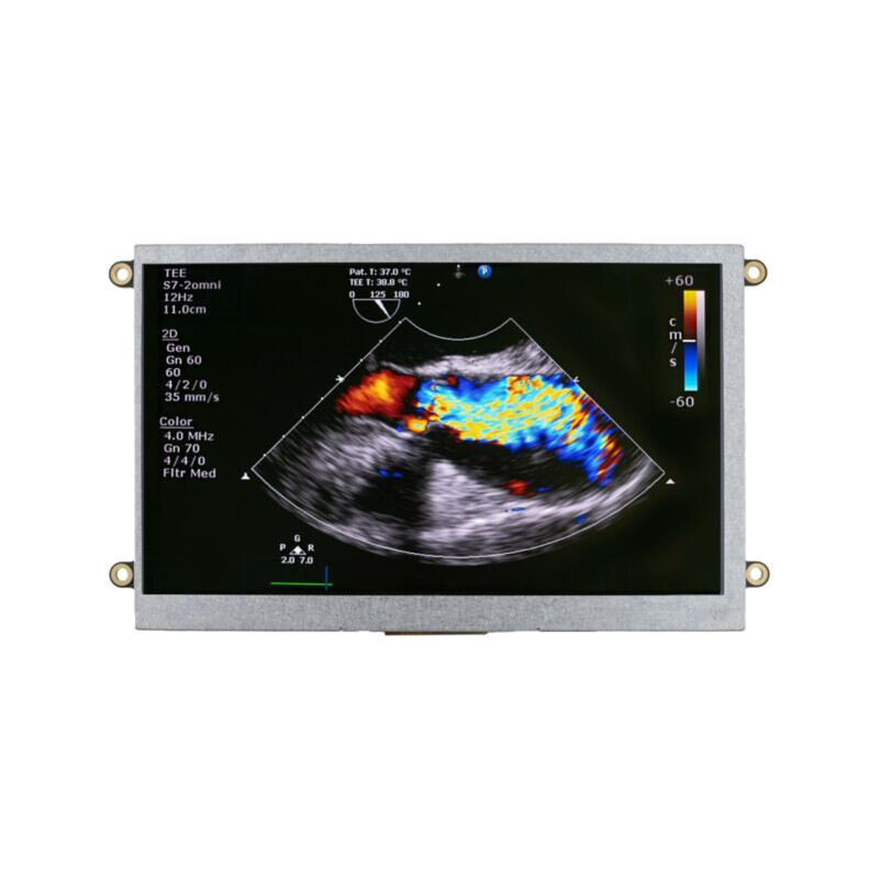 Afişaj: TFT; 7"; 800x480; Ilum: LED; Dim: 180,1x104x16,6mm; RGB; 5VDC
