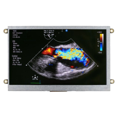 Afişaj: TFT; 7"; 800x480; Ilum: LED; Dim: 180,1x104x16,6mm; RGB; 5VDC
